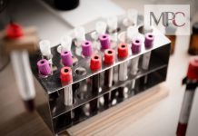 MPC/DF entra com representação a respeito da testagem para o novo coronavírus e chama a atenção para a precariedade das UBS