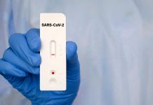 A fiscalização pelo MPC/DF a respeito da aquisição de testes para o combate à COVID19